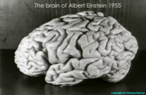 einstein_brain